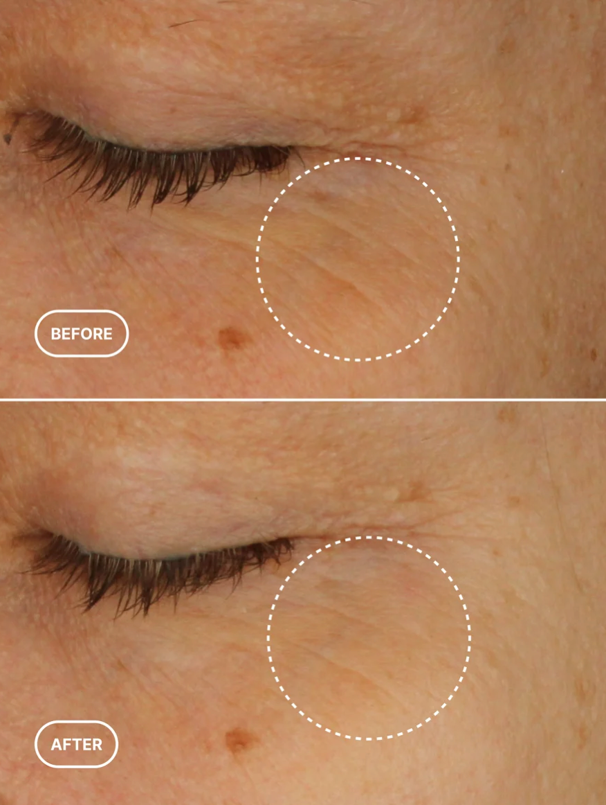 Noctis – Eye Renewal Retinol Serum